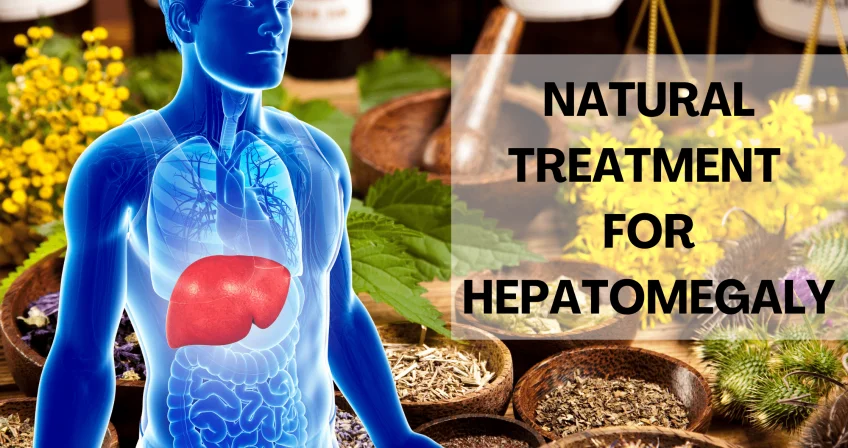 What is Hepatomegaly